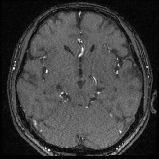 Click on the Serie image to view the images of VILLANUEVA, WILLIAM A.